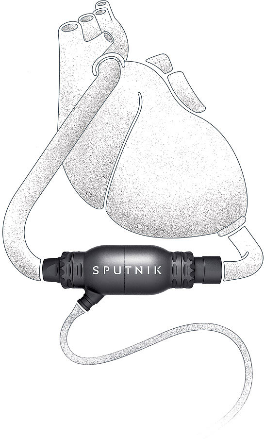 sputnik heart